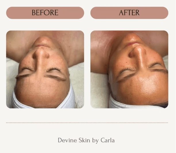 Devine Skin by Carla